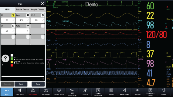 Early Warning Score (EWS)