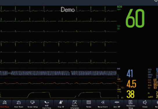Cutting-Edge Technology – Smarter, More Efficient Monitoring