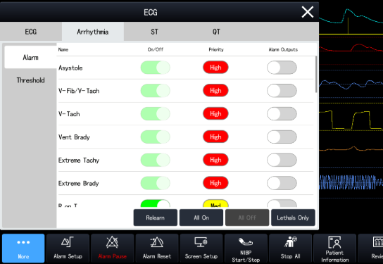 Cutting-Edge Technology – Smarter, More Efficient Monitoring
