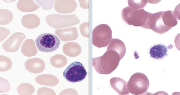 3-Part Hematology Analyzer