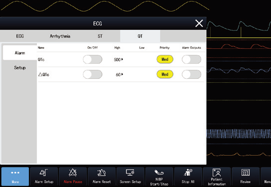 Cutting-Edge Technology – Smarter, More Efficient Monitoring