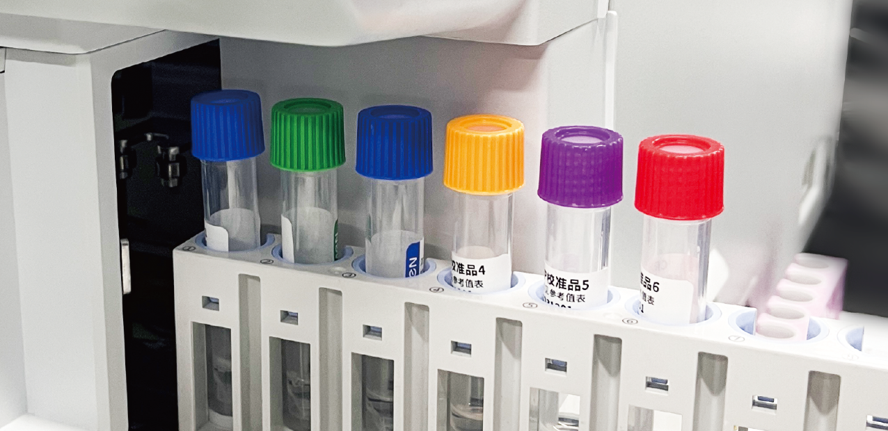 Automated Calibration