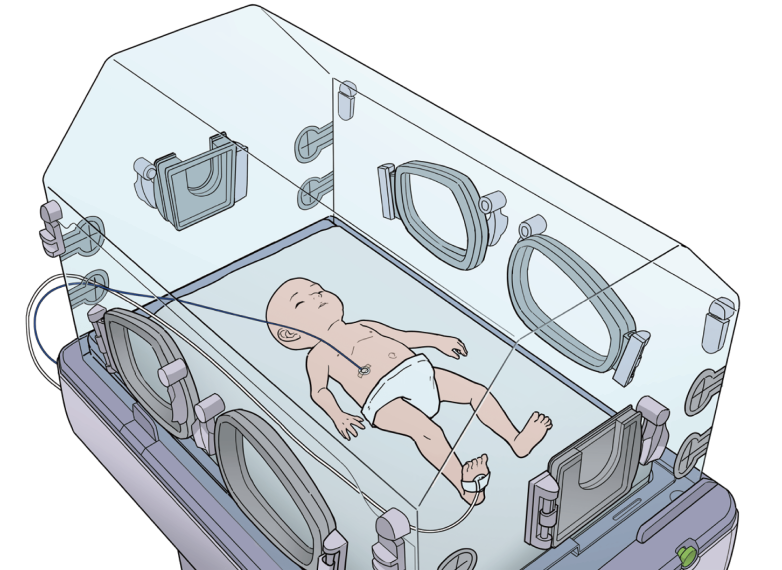 Infant connected to the B3 apnea rescue system